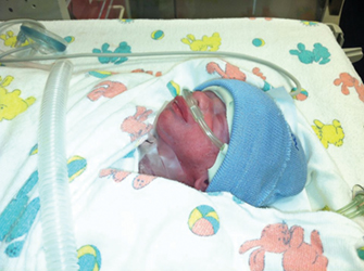 He weighed just 2 pounds 15 ounces. 